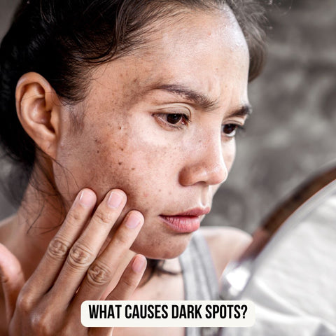 https://cdn.shopify.com/s/files/1/0532/0998/9283/files/What_Causes_Dark_Spots_480x480.jpg?v=1727333936