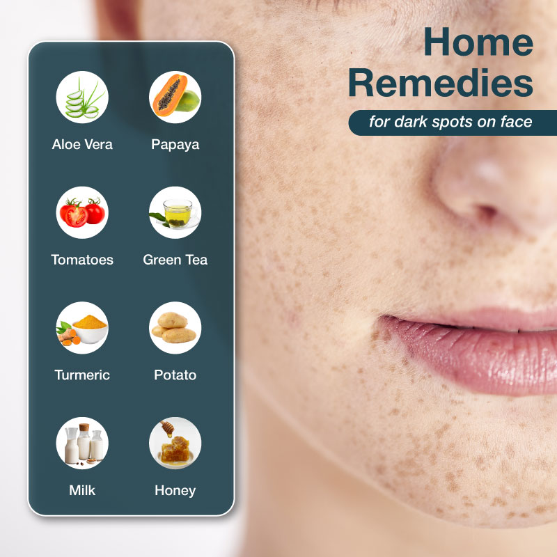 https://media.olivaclinic.com/website-media/2025/09/home-remedies-for-dark-spots-on-face.jpg